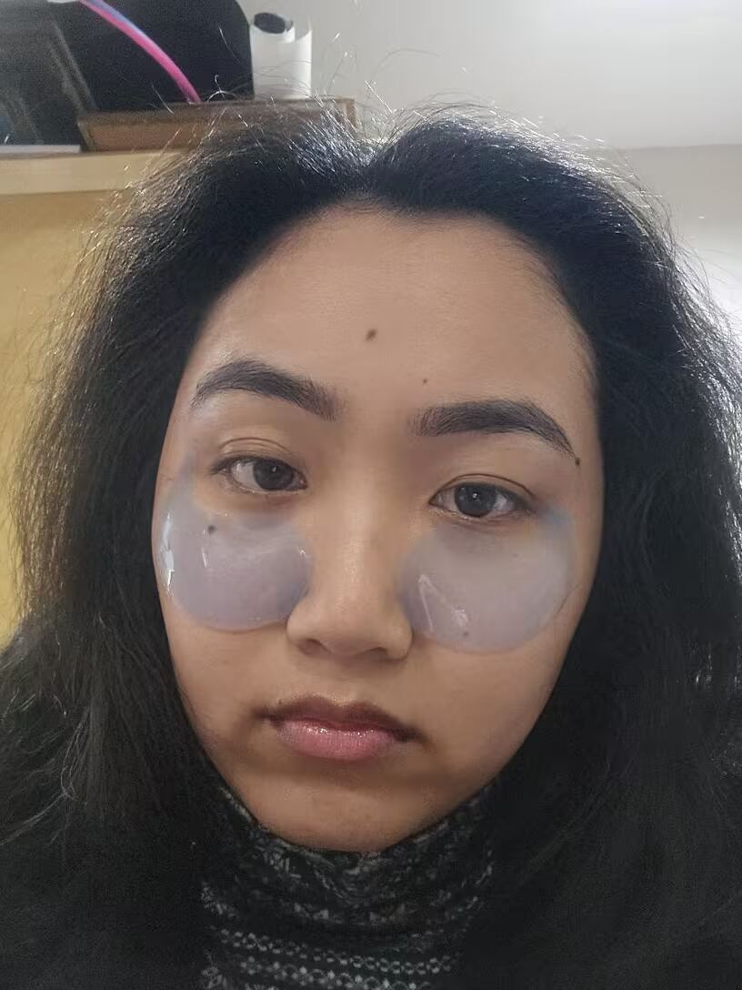 Before and after skin brightening result
